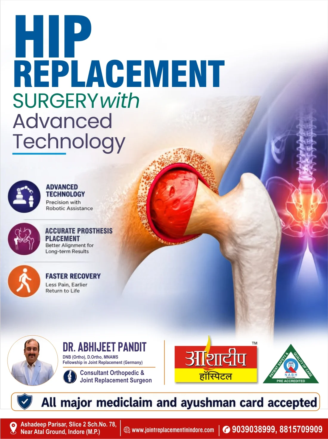 Hip Replacement Surgery in Indore: A Guide to Treatment and Recovery